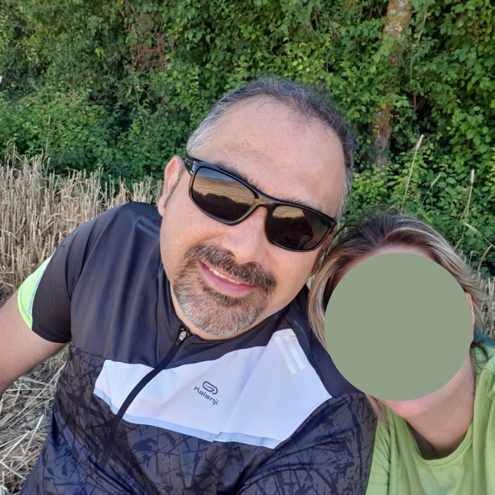 Caso real de trasplante capilar
