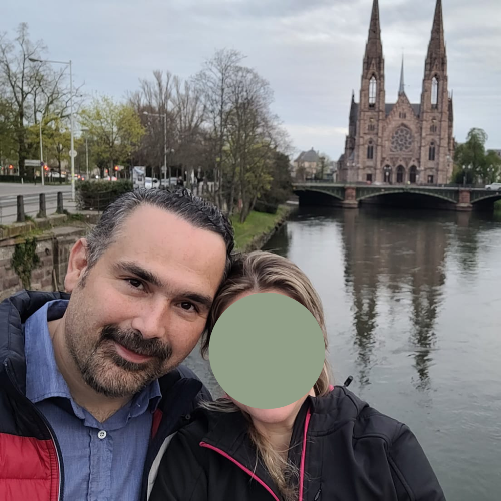Resultado de trasplante capilar